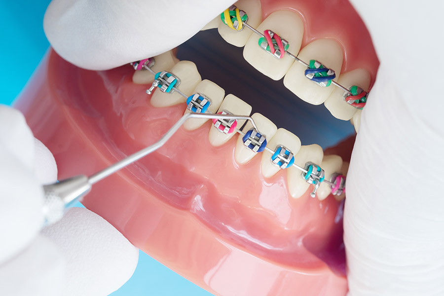 Kieferorthopädie